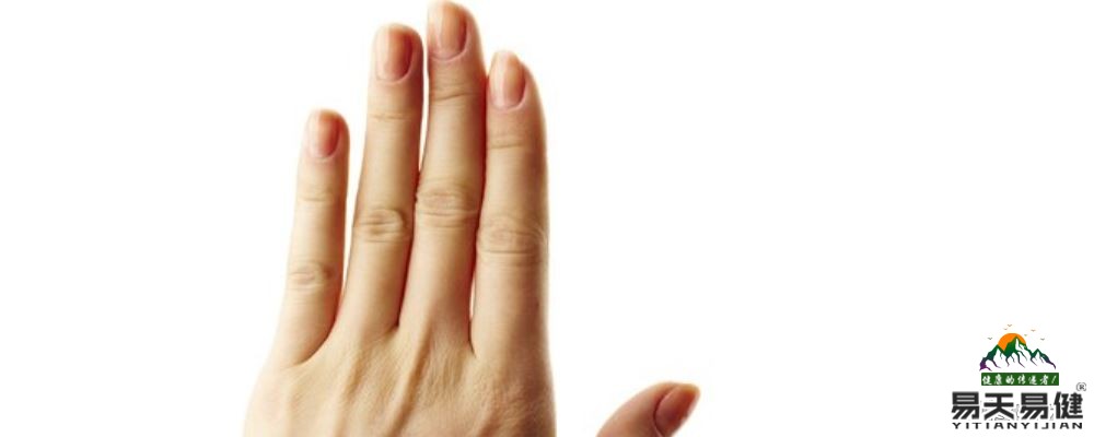 指甲表面有竖线是什么原因 如何从指甲看健康