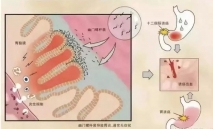 一家7口全部感染Ⅰ类致癌物！你家可能也有！